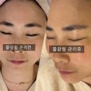 부산 명지 휘담에스테틱 3D물광필 관리 후기 웨딩 피부관리 전문샵