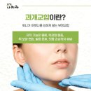 창원교정치과 과개교합 교정 시 중요한 포인트?