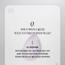 펄미에이트 이미지