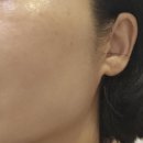 에스제이과학 | 평택피부관리 SJ 파메스테틱 피부연구소 피부가 당길 땐 영양물광 관리