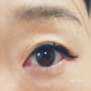 아이젠트리 위드렌즈 양산 증산점 | 뉴에버 원데이 투명렌즈 체험기 - 아이젠트리 위드렌즈 양산증산점에서 만난 특별한 경험