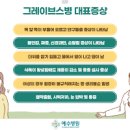 그레이브스병 원인 증상 치료 눈이 튀어나오는 그레이브스병 그레이브스병 임신 이미지