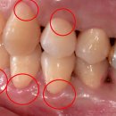 상아치과재료 이미지