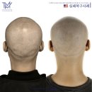 탈모왕 광주점 이미지