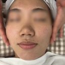 율량동 여드름관리 추천 한결피부앤바디 청주율량점 피부결 개선 후기