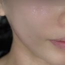 더 페이즈 | 쿨페이즈 가격 효과 통증 후기 vs 써마지