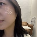 플러스비 | 기미잡티크림 유명한 신데렐라매직크림 비플러스솔루션 후기