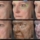 이노메드 이미지