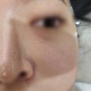 피부관리콜 이미지