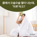 몸에서 으슬으슬 열이 나는데, ‘치루’라고? 이미지