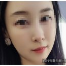 압구정튠의원 이미지