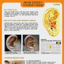 경혈테라피 이미지