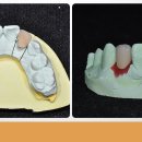 초심치과기공소 이미지