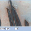 30대초반 남자 회사원, 지성두피,지루성 피부염, 스트레스,영양불균형, 탈모두피 전문관리센터, 닥터스칼프 영통점 이미지