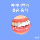 김재원치과의원 | 치아미백에 좋은 음식 5가지, 익산치과