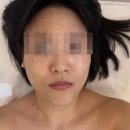 홈케어서비스연구소 | 피부관리 심미안연구소 VLTSPA 피부열감진정케어 역대급 후기 트러블관리 여드름관리 피부샵 에스테틱 추천