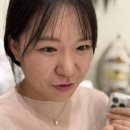 조락 | 코조각주사 콧볼보톡스 복코 전후 효과 통증 가격 후기