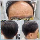 슈앤모중모가발 | 대구 달서구가발 당일착용가발도가능한 슈앤모 명장에게