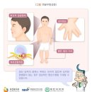 배아 또는 태아 대상 유전자 검사 가능 유전질환 7개 추가 선정 이미지