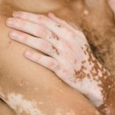 센텀모빅스피부과의원 이미지