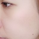 모든 피부 타입에 사용할 수 있는, 수분 진정 케어 &#39;셀로디온&#39; 포스트 서저리 세럼