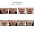 리프업의원 이미지