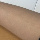 365플러스 의정부가능 | 의정부피부과 의정부젠틀맥스프로플러스 팔 전체 제모 후기