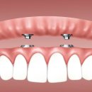 정은주ㆍ김석치과의원 이미지