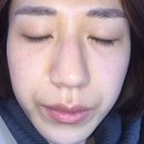 예사랑피부과 이미지
