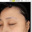 퍼스트의원 | 광교퍼스트피부과 의원 내돈내산 후기