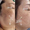 예담에스테틱 네이버블로그