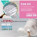 웰리온 이미지