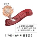 위