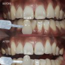 서울감동치과의원 이미지