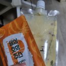 강남최선생 | [쌍커플 재수술] 내돈내산, 은하수 성형외과에서 10년된 겹쌍 제거 후기