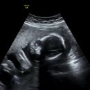 보배하이마트 | W여성병원/보배반점 수완점/아이폰14pro 액정파손,리퍼후기