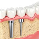 바른샘치과의원 이미지