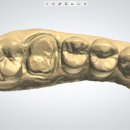 틀치과기공소 이미지