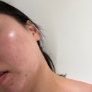 오하에스테틱 부산센텀점 | 해운대 피부관리 에르모듀관리 받고 온 오하에스테틱 센텀점 후기
