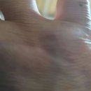 이엽한의원 이미지