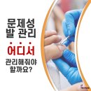 나도손톱 레푸스 개봉점 이미지
