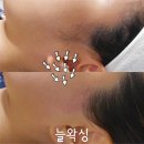늘왁싱