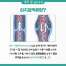 하지정맥류, 나이가 들면서 자연적으로 좋아질 수도 있을까? 이미지