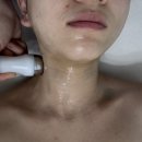 광주피부관리 추천 | 에이치앤에이치더바디 쏙케어 후기 | 이중턱 관리 고민이라면