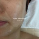 초전동에스테틱 썸머브리즈
