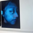 기미·주근깨 레이저시술, 루카스레이저 실제 후기 (전·후 사진 있음)
