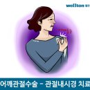 어깨회전근개파열시 증상과 수술법은?? 이미지