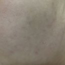 피부에오광(光)