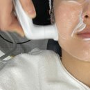차이의원 | 합정 차이의원ㅣ코레지 리프팅 후기ㅣ30대 리프팅 추천