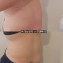 탄금호순환자전거길 2L | 누워서 뱃살빼는 복부 다이어트 온열해독관리 부천중동피부관리